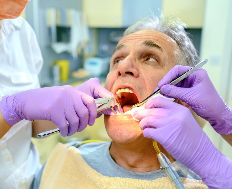 Tooth Extractions