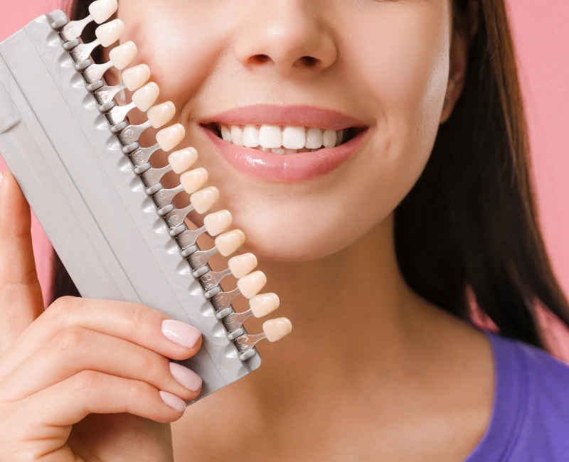 Dental Veneers in Woodbridge, Vaughan