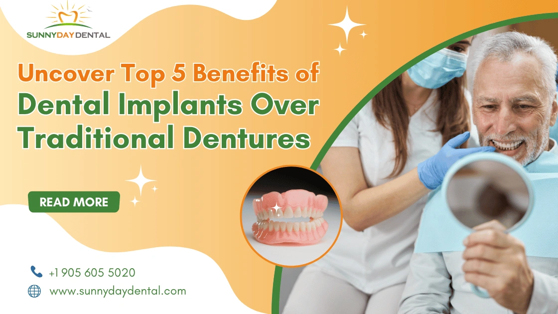 Dental Implants Benefits