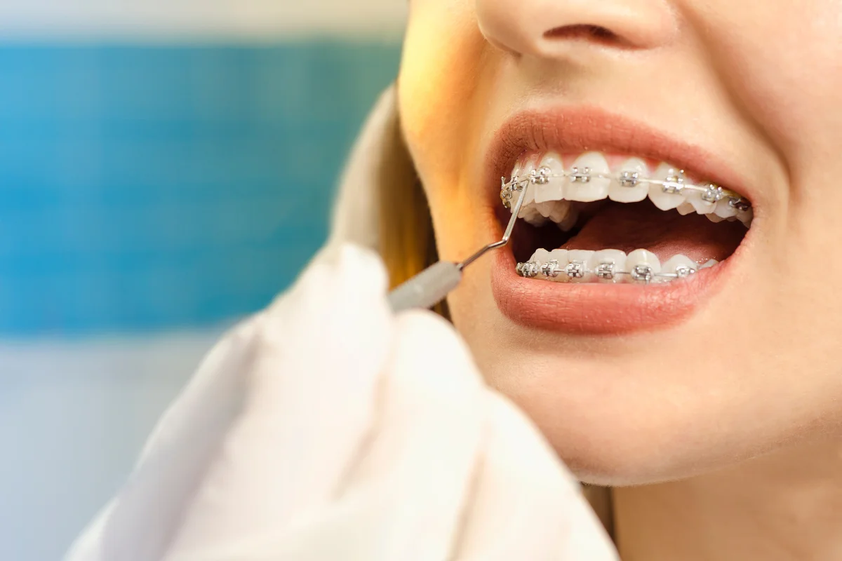 Orthodontists in woodbridge vaughan