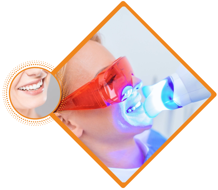 Zoom whitening in Woodbridge