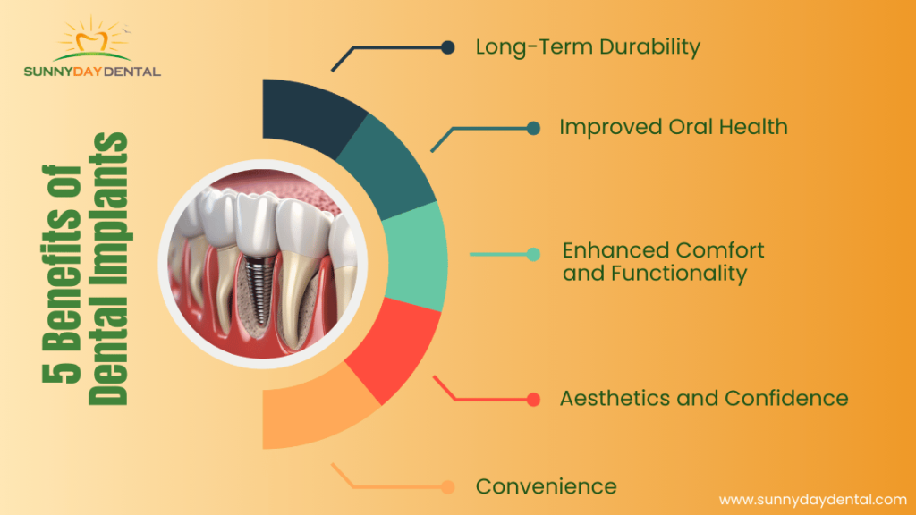 The Benefits of Dental Implants