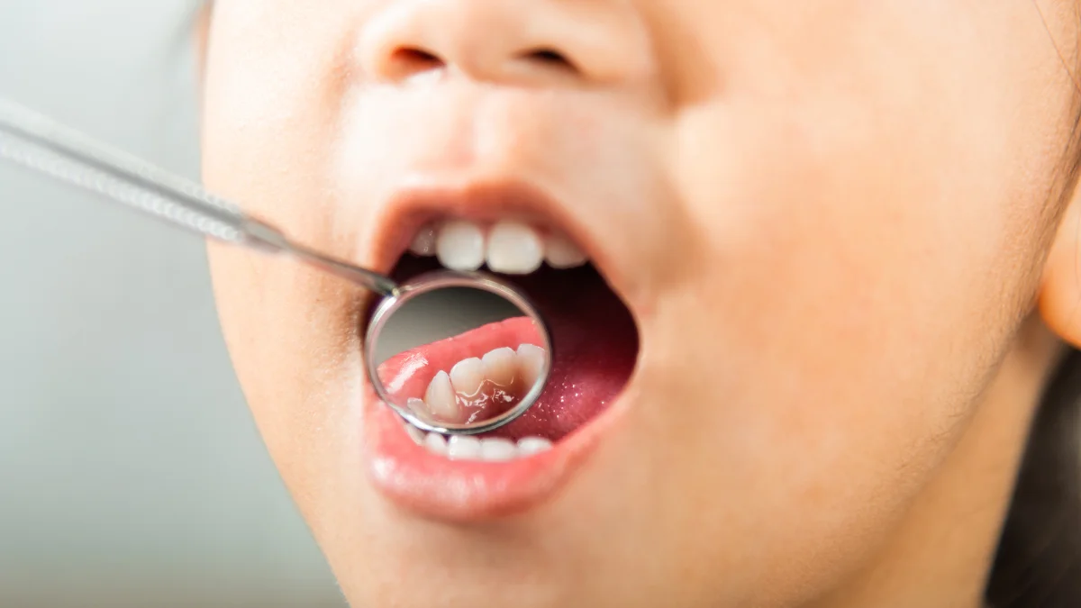 Primary Teeth health