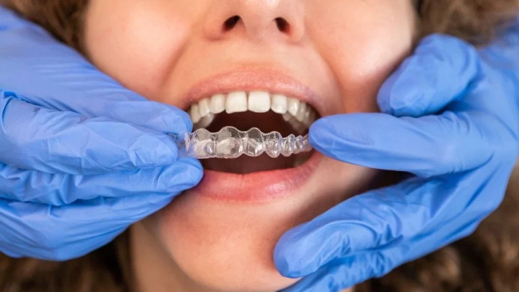 Invisalign Treatment