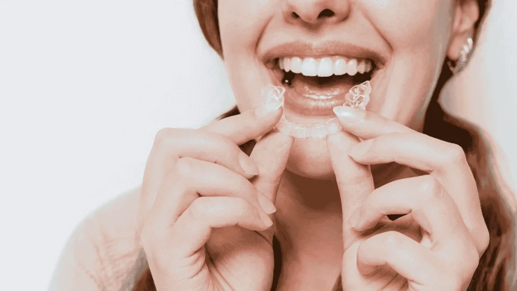 Teeth Straightening for Adults