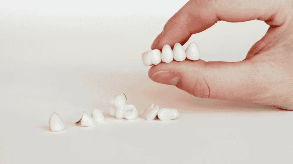 Porcelain Crowns