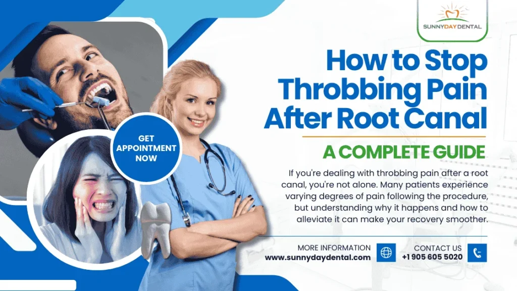 How to Stop Throbbing Pain After Root Canal: A Complete Guide