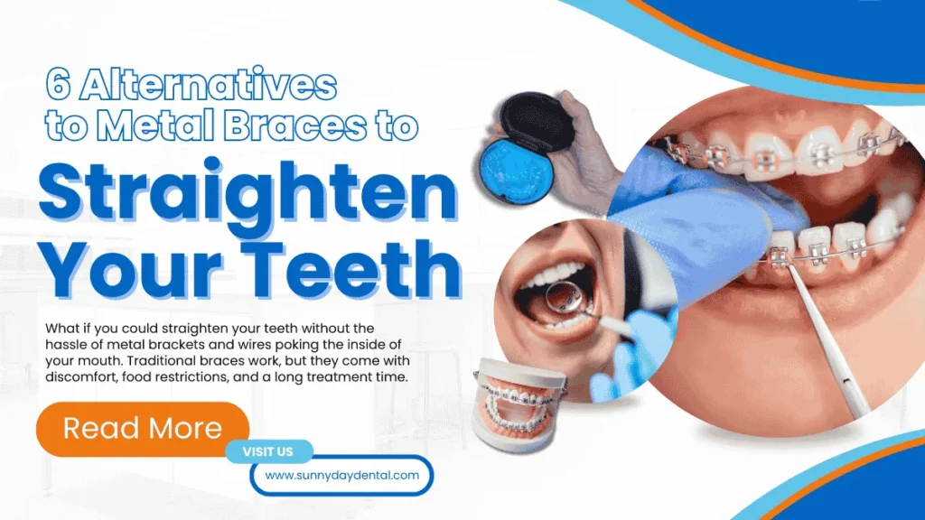 alternatives to metal braces