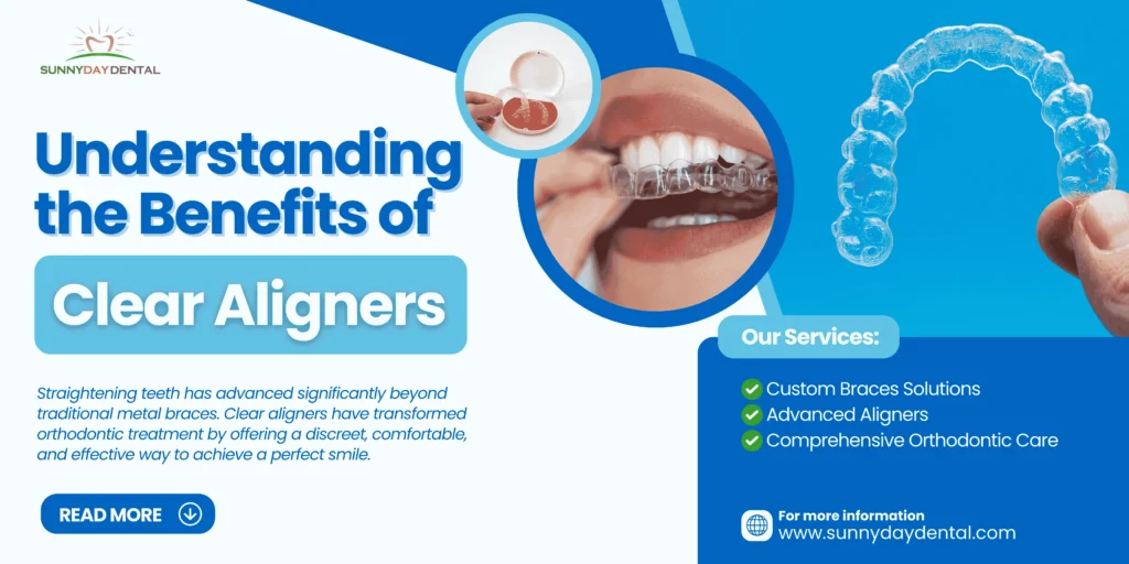 benefits of clear aligners