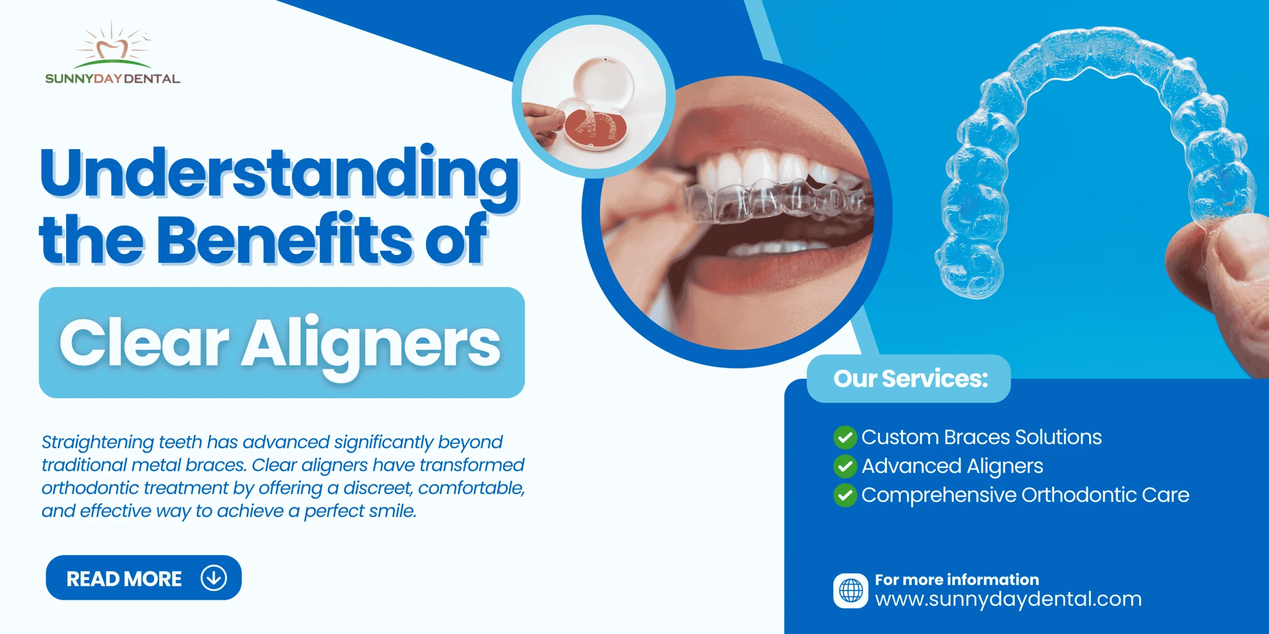 benefits of clear aligners