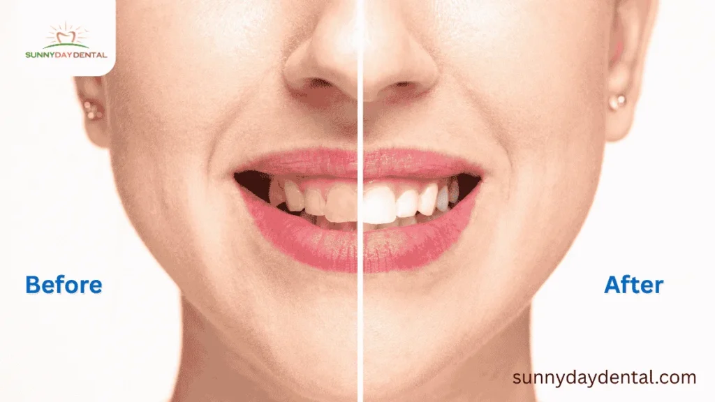 Skip Your Dental Cleanings