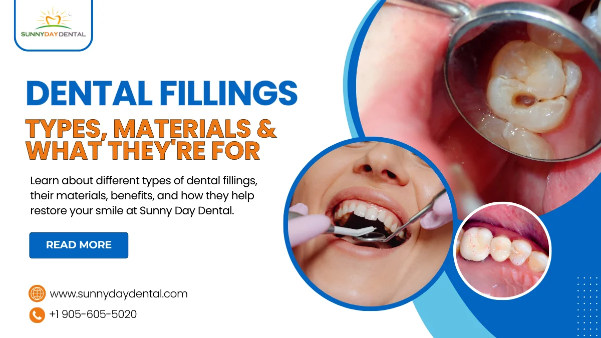 Dental Fillings