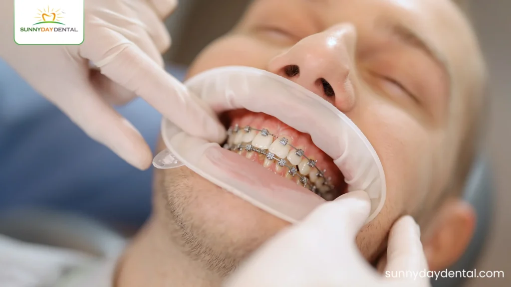 Orthodontist in Woodbridge