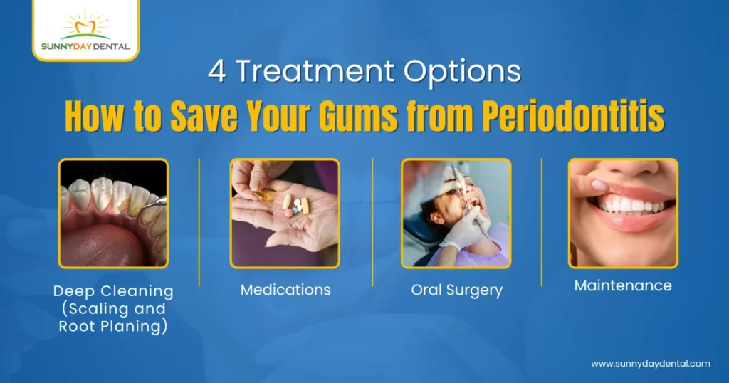 4 Treatment Options: How to Save Your Gums from Periodontitis