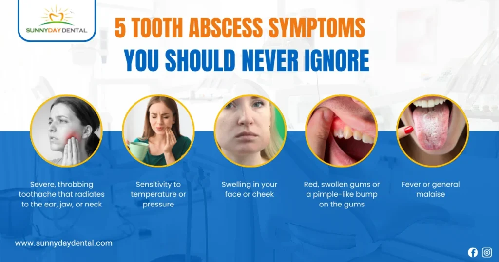 5 Tooth Abscess Symptoms