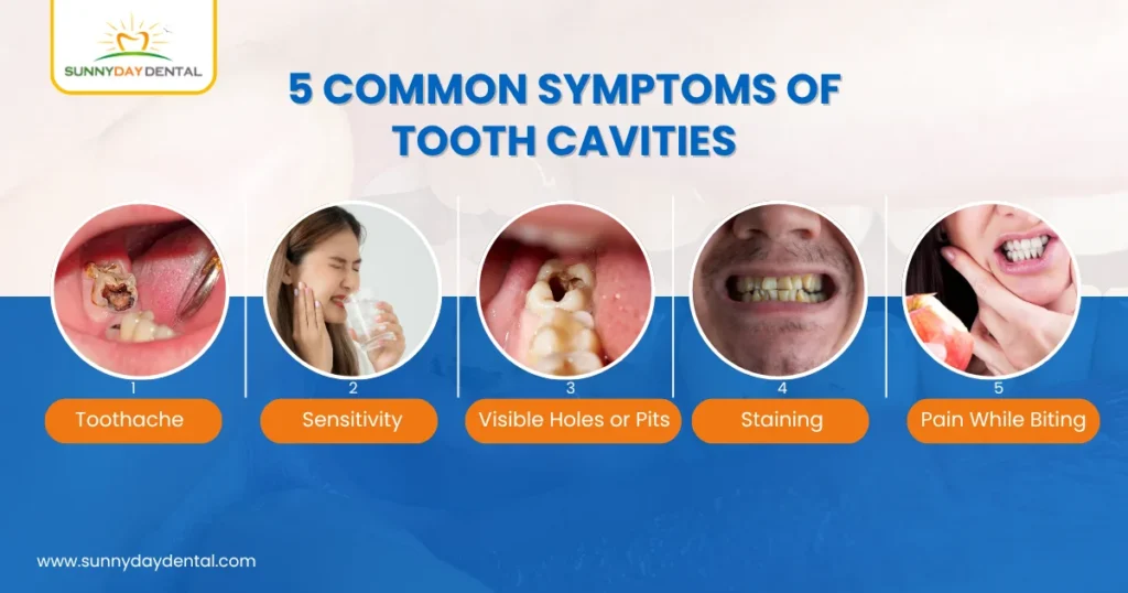5 Common Symptoms of Tooth Cavities