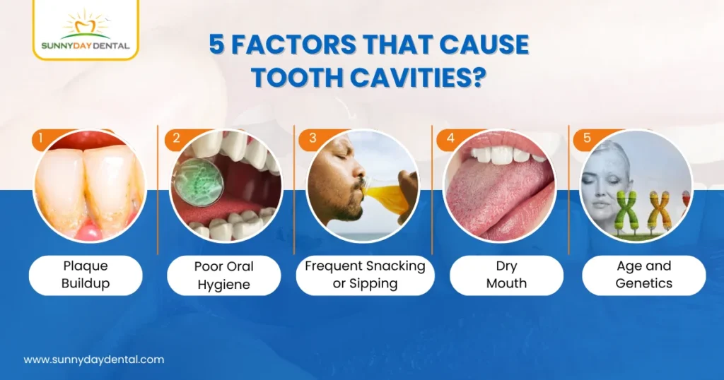 5 Factors That Cause Tooth Cavities?
