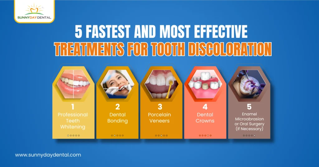 5 Fastest and Most Effective Treatments for Tooth Discoloration