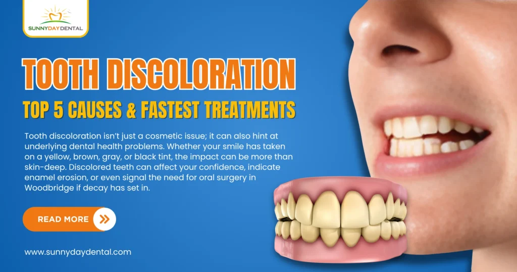 Tooth Discoloration