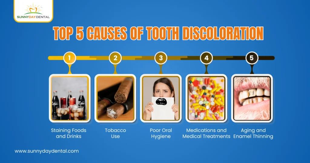 Top 5 Causes of Tooth Discoloration