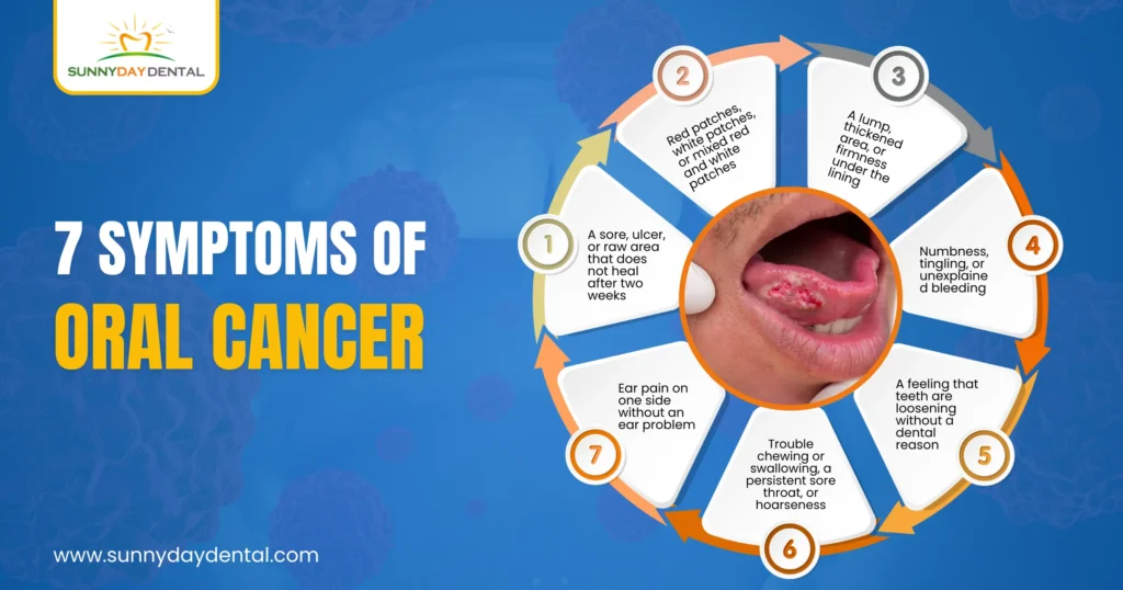 7 Symptoms of Oral Cancer