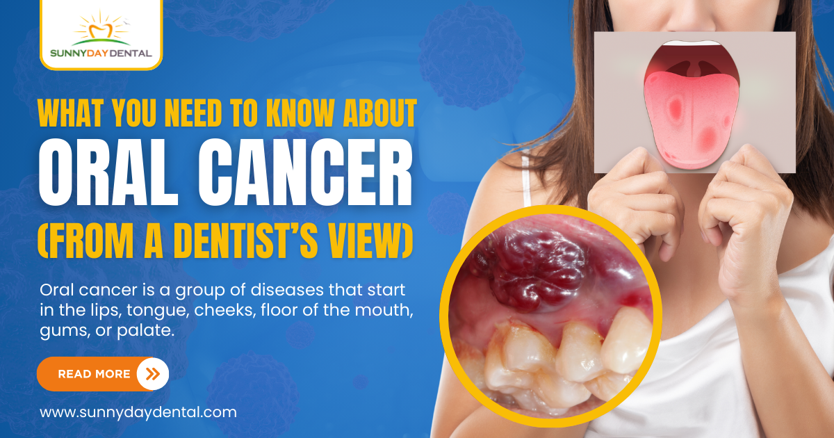 Oral cancer