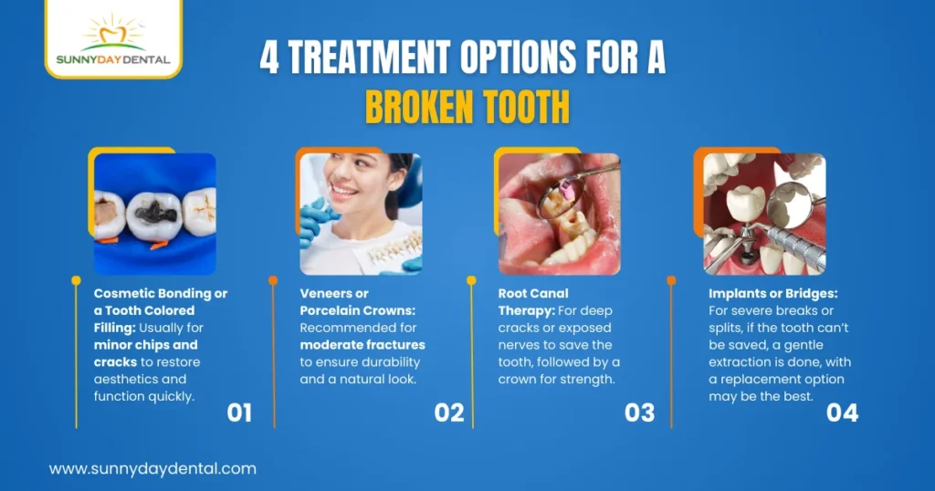 4 Treatment Options for a Broken Tooth
