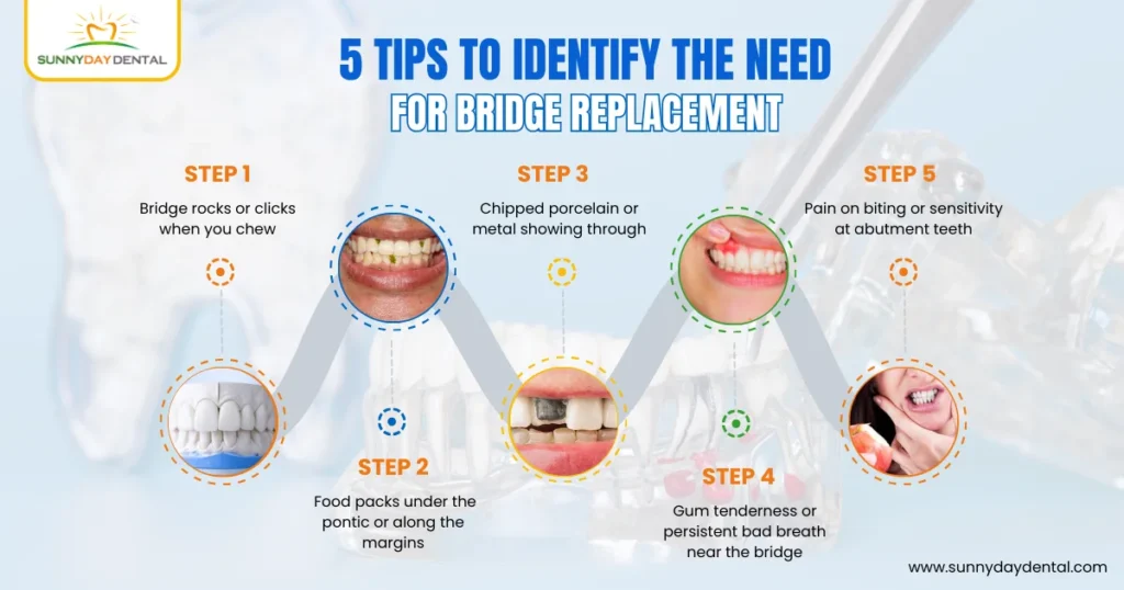 5 Tips to Identify the Need for Bridge Replacement 