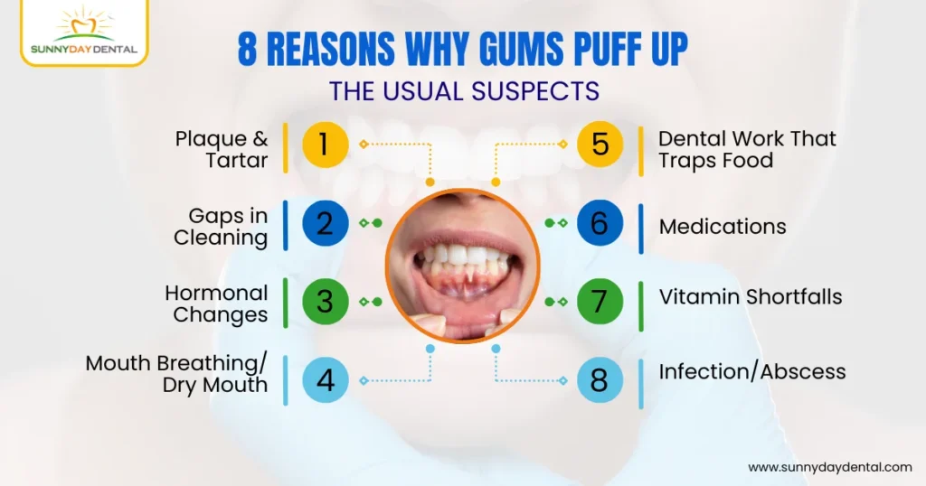 8 Reasons Why Gums Puff Up: The Usual Suspects
