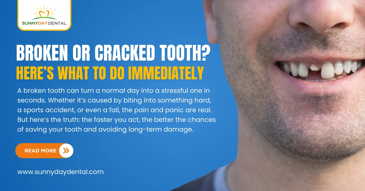 Broken tooth