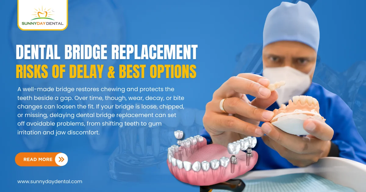 Dental Bridge Replacement
