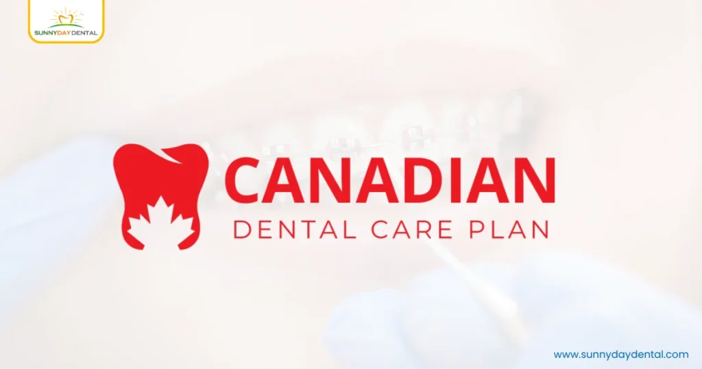 Dental braces cost
