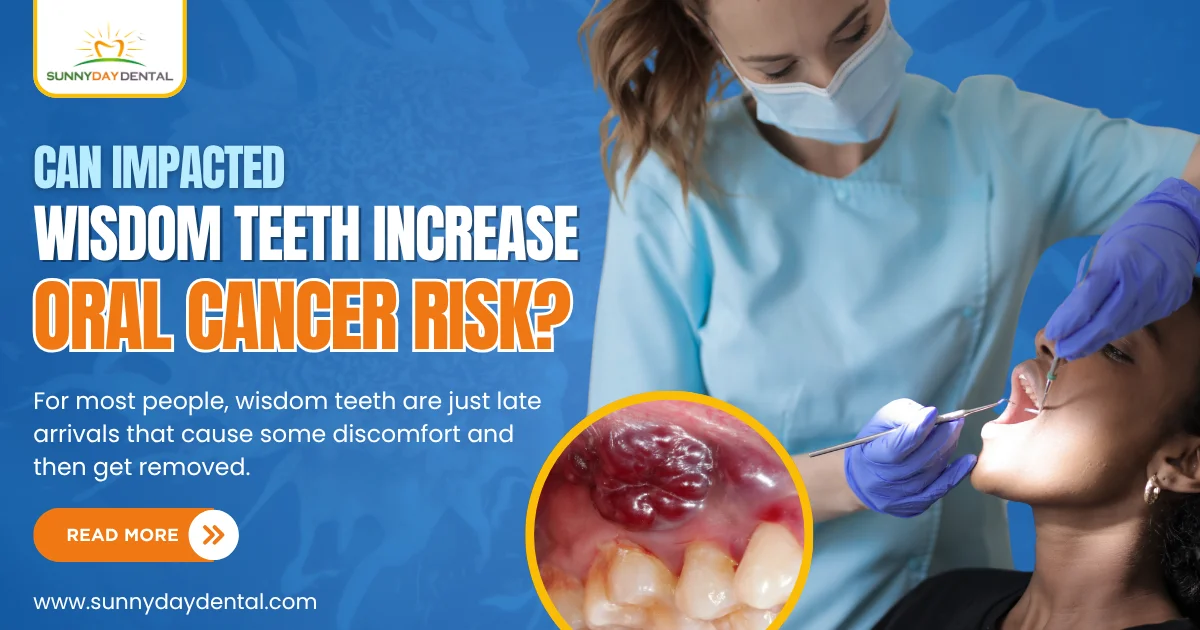 Impacted Wisdom Teeth Increase Oral Cancer Risk