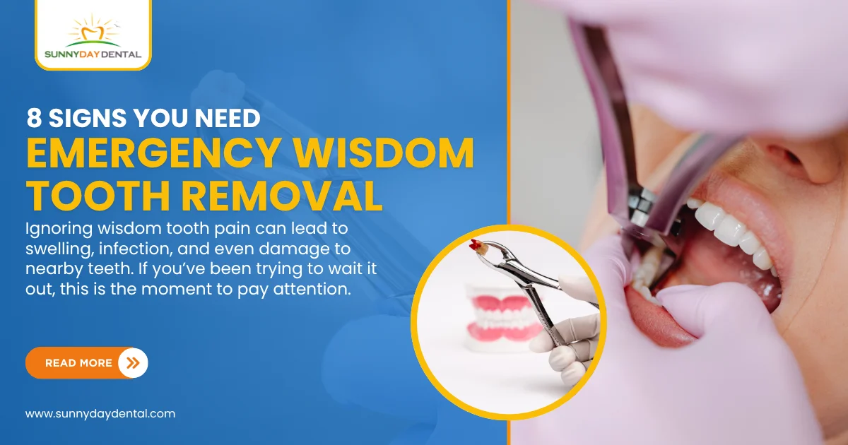 Wisdom tooth removal