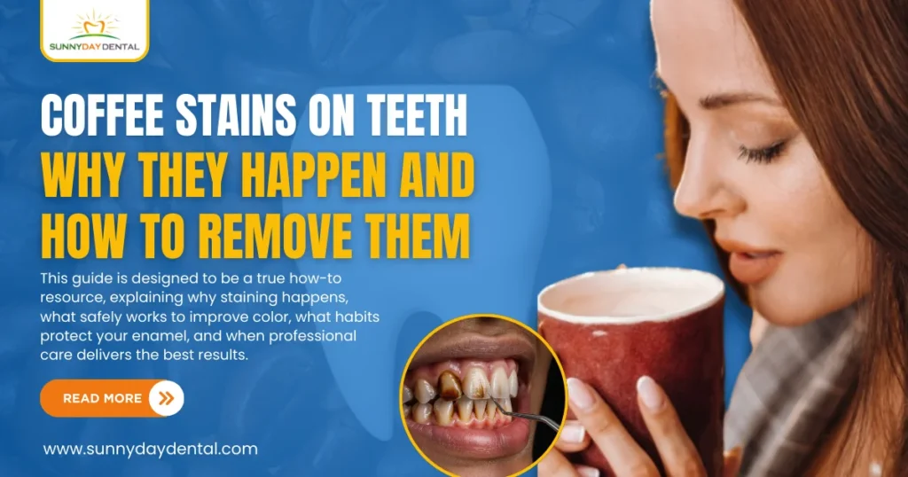 coffee stains on teeth