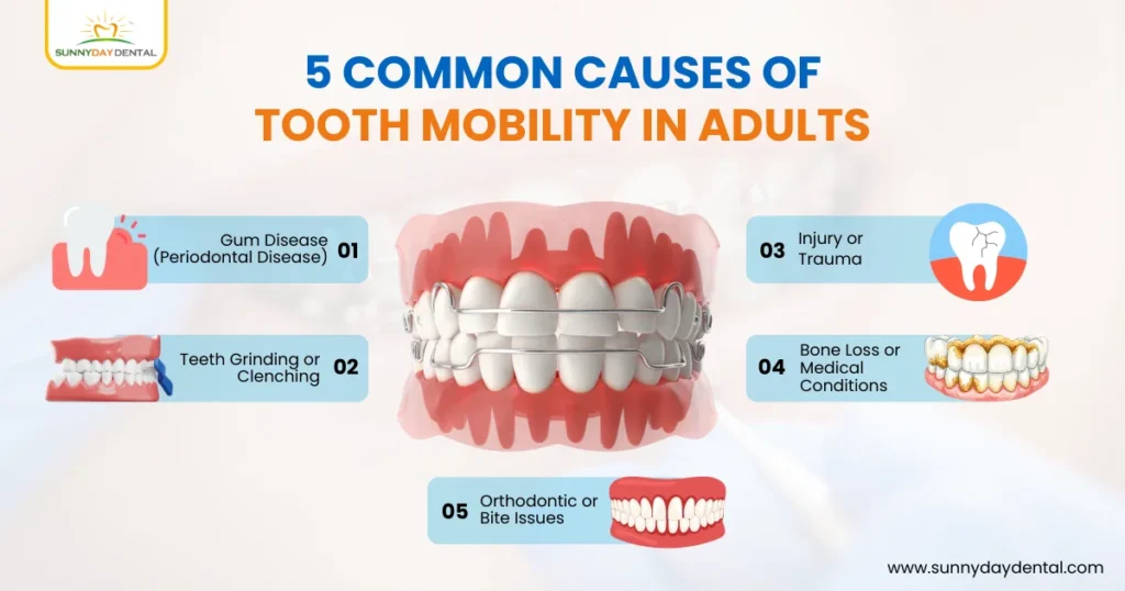 5 Common Causes of Tooth Mobility in Adults
