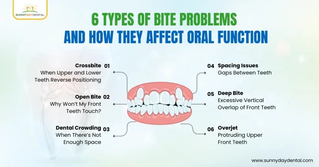 6 Types of Bite Problems and How They Affect Oral Function
