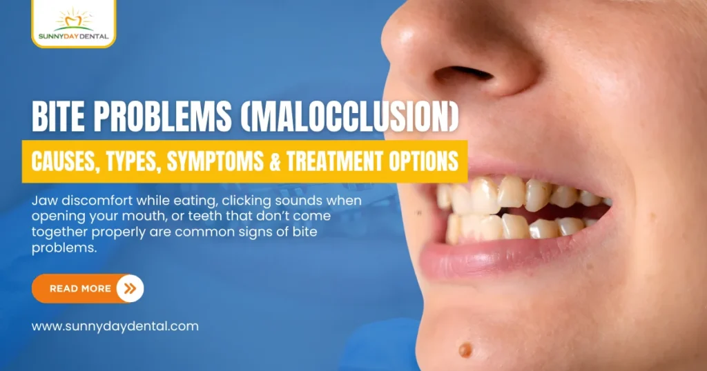 Malocclusion