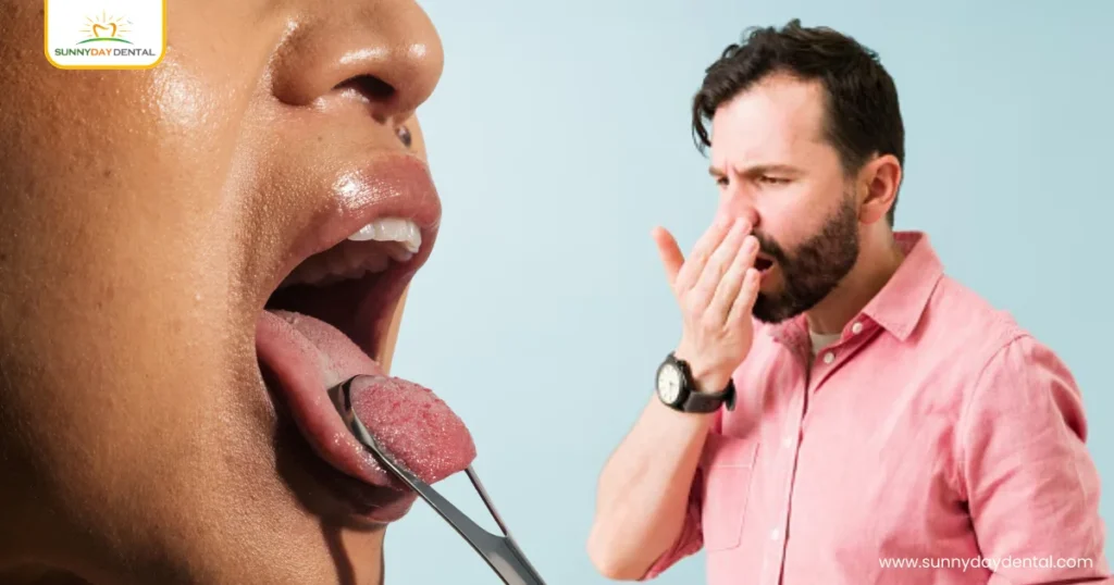 Tongue Scraping for Bad Breath, What You Should Know