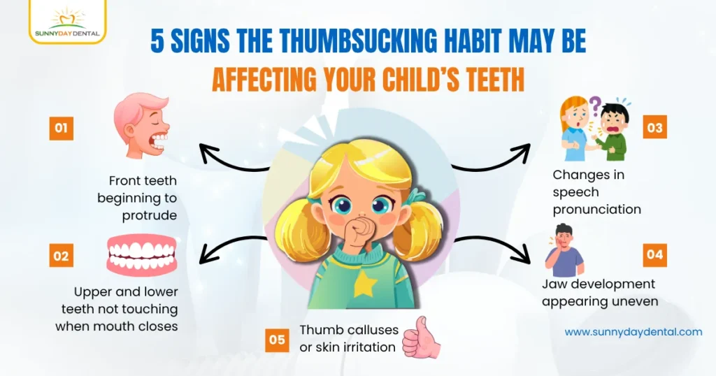 5 Signs the Thumbsucking Habit May Be Affecting Your Child’s Teeth
