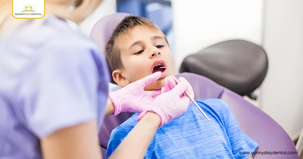 Dental Sealants for Children: A Powerful Preventive Tool