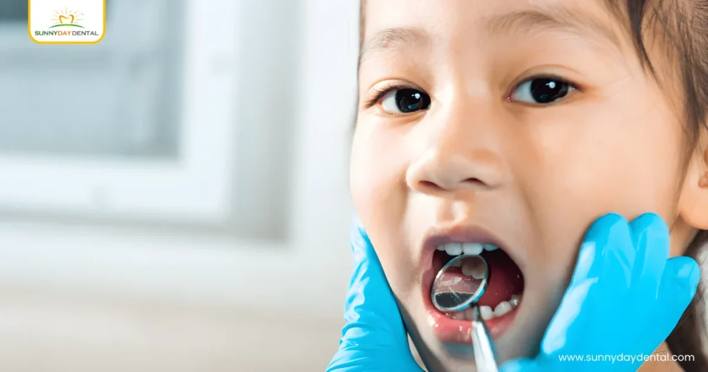 What Are Cavities in Children