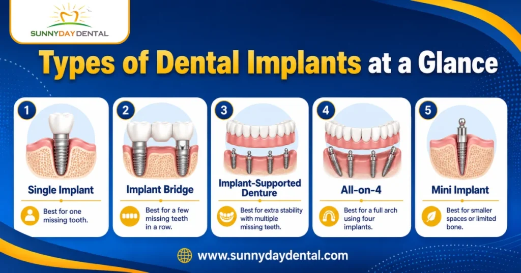 Types of Dental Implants at a Glance