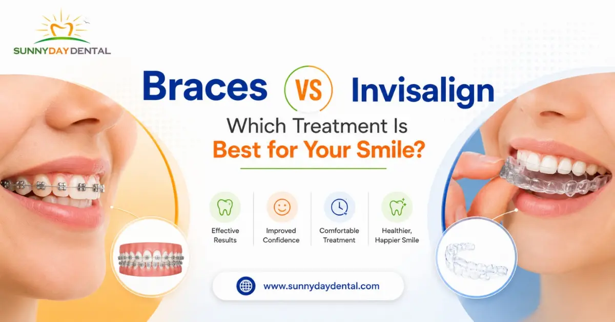 Braces vs Invisalign