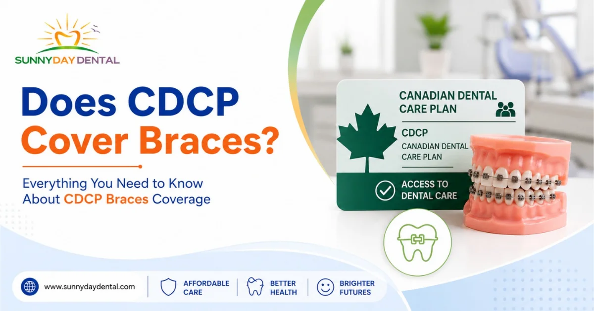 Does CDCP Cover Braces