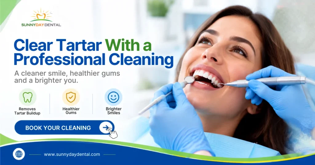 Clear Tartar With a Professional Cleaning