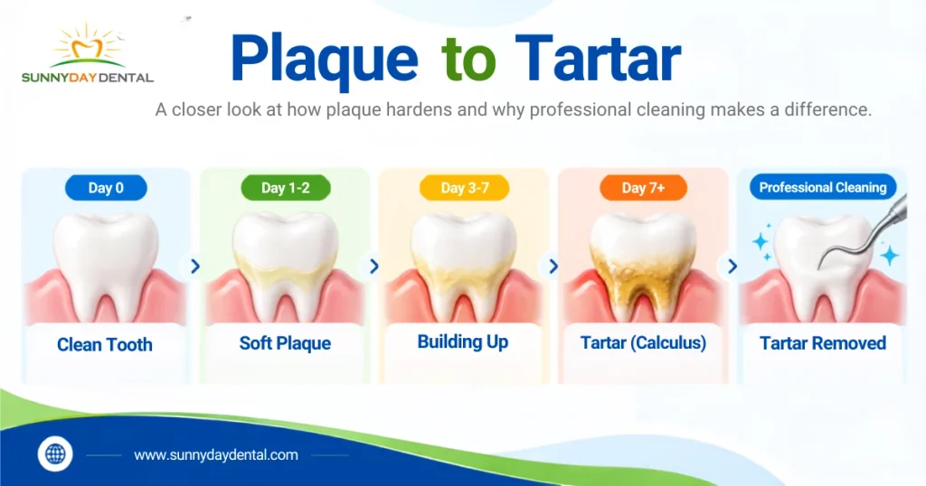 Plaque to Tartar